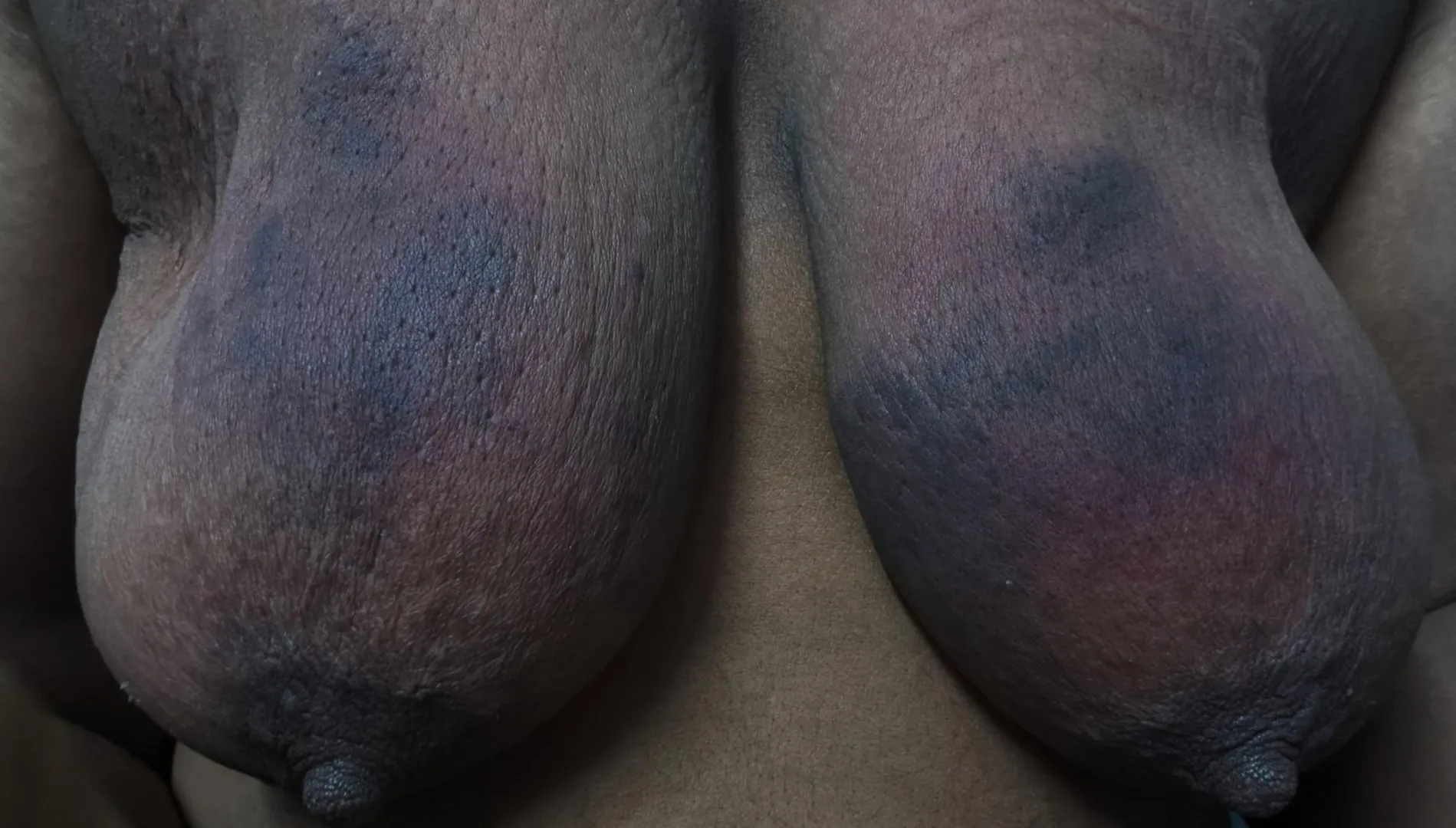 Can i get more ideas to give myself more pain ? posted by nonameobject