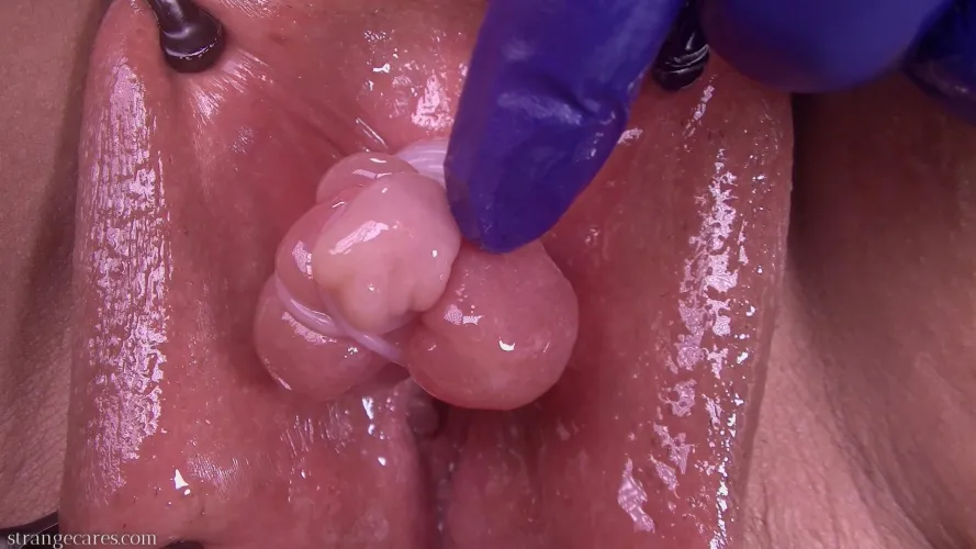 can you even tell it's a clit anymore?  pumped and tied up with rubber bands [nb] by strangecares