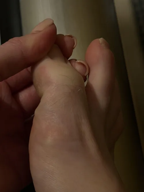 Can you keep my secret? I secretly have hairy toes! by SkinnyScarlett