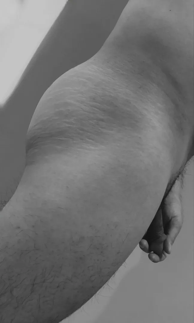 Can you see the scar  posted by WilhelmYR