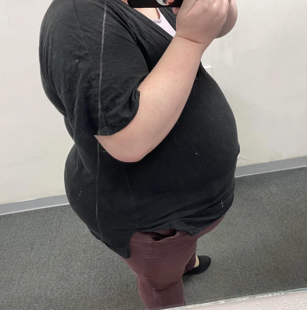 Can’t tell which side sticks out worse posted by smittensamantha