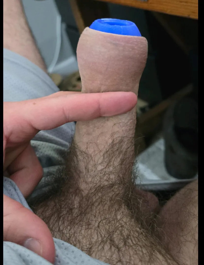 Celebrating the little wins ~ Pear retainer no longer pops off with an erection  posted by GimmeBackMyForeskin