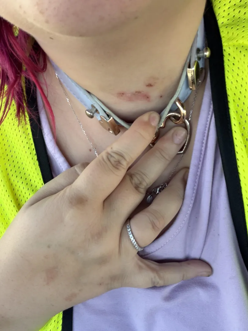 Collar chafing? posted by Outside-War2802