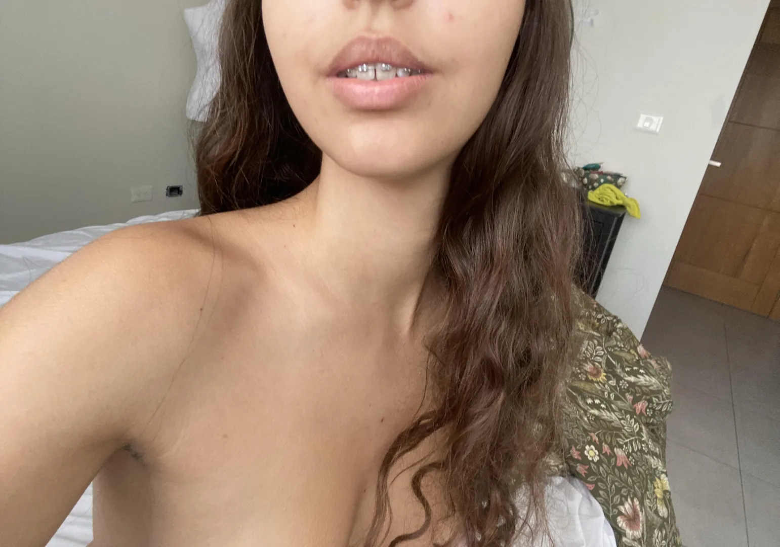 Come get a taste of these braces posted by da_bich-men