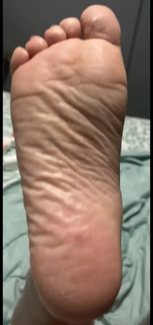 Congratulations! My wrinkly soles are out and You're on wrinkle counting duty. posted by arboldebolas