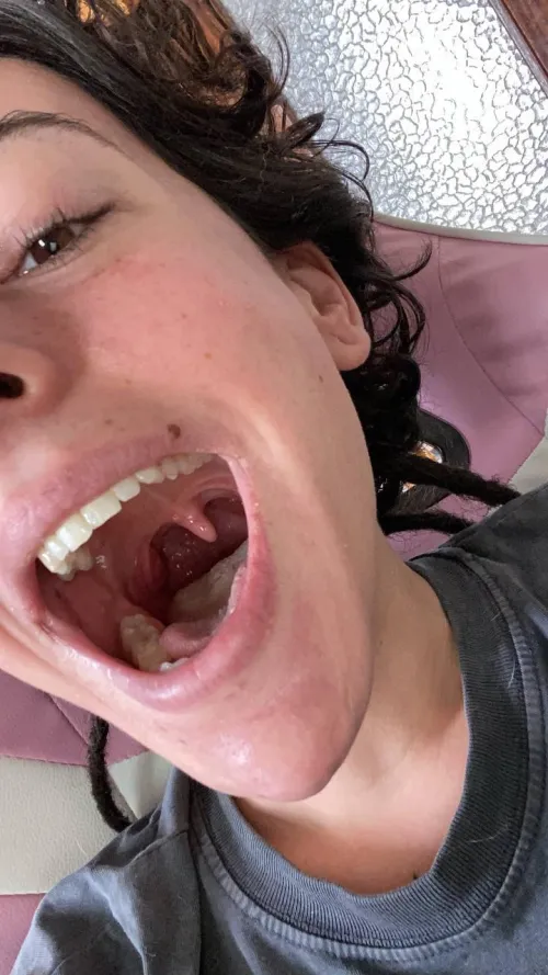 CUSTOMS OPEN. I’m back with some #uvula. Beautiful huh? tl: rgsar03 by AtheneaRain