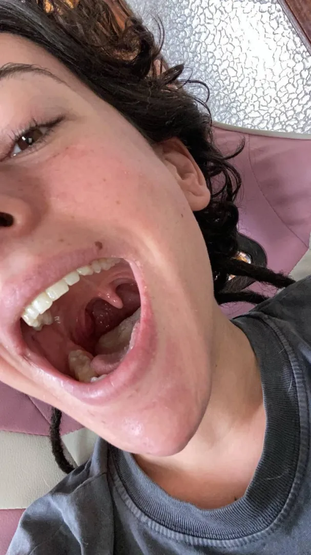 CUSTOMS OPEN. I’m back with some #uvula. Beautiful huh? tl: rgsar03 posted by AtheneaRain