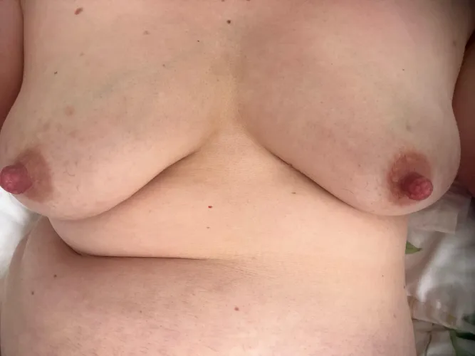 Day 8. Feeling firmer and milk coming through by DisastrousReindeer79