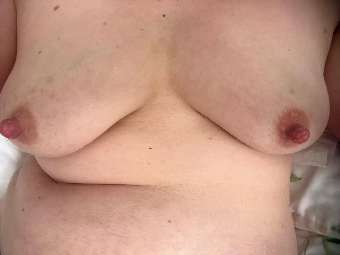 Day 8. Feeling firmer and milk coming through posted by DisastrousReindeer79