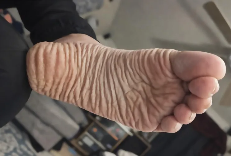 deep wrinkled heel soles by DeepWrinkleSoles
