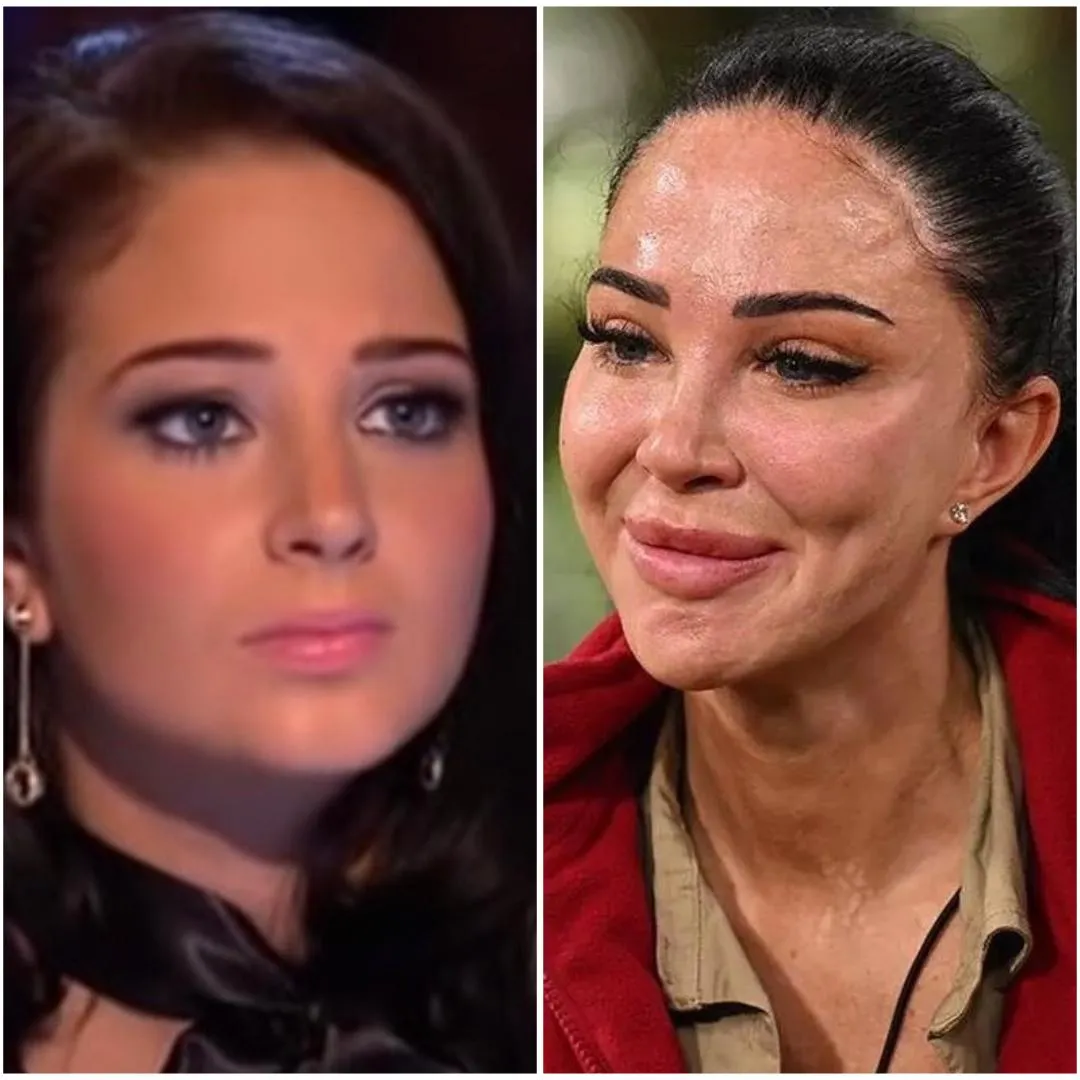 Did a quick google search and was quite surprised.. posted by Fermented_Dog_Cum