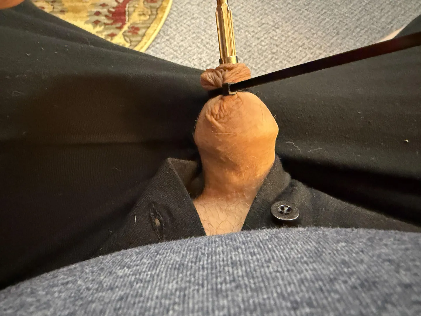 Do a Revision with ZSR or no? posted by Artistic-Language807