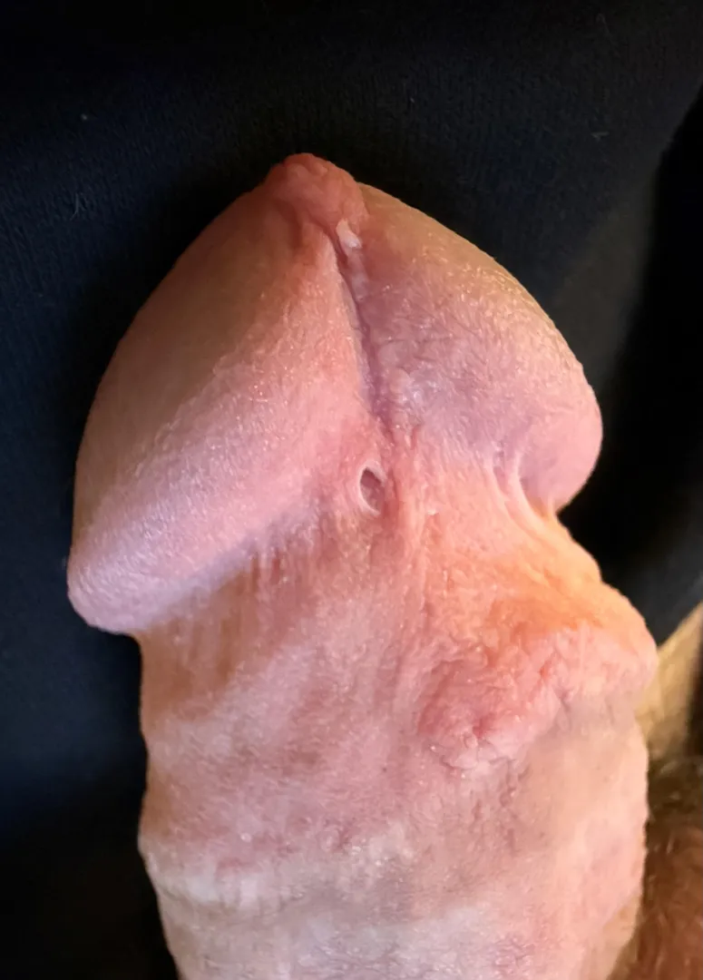 Do I need to get it repierced? posted by EasternElection2175