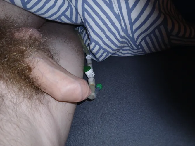 Do you also get horny when you have a catheter in you? I notice that I am getting hornier and hornier, grrr, but I will see how I solve that because I will probably have to have a catheter permanently. There is a 5 percent given by the urologist that I c by baak20001