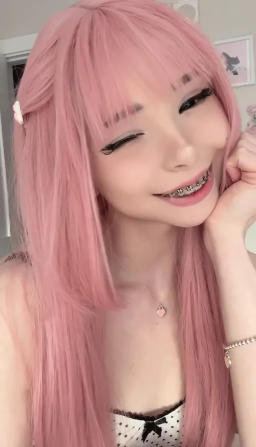 Do you like my braces by _LustyDoll