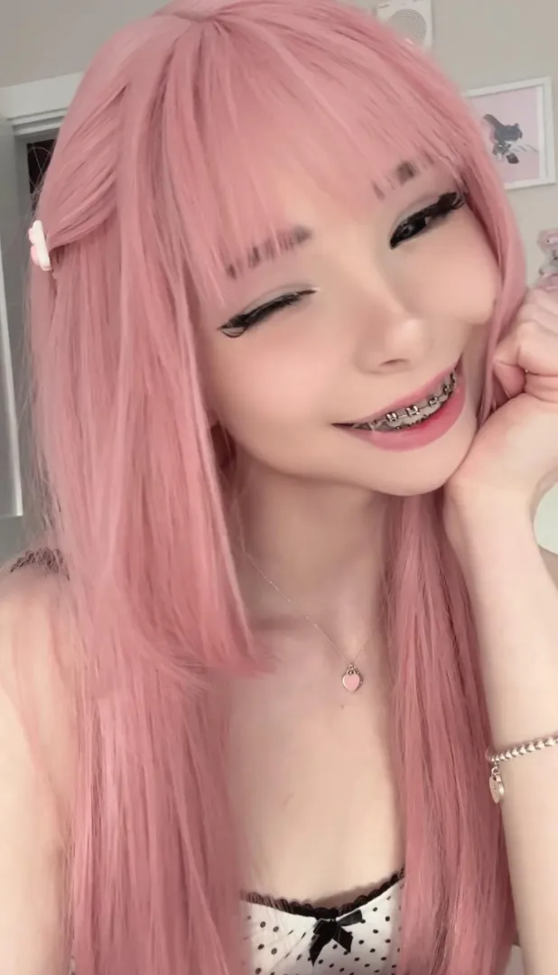 Do you like my braces posted by _LustyDoll