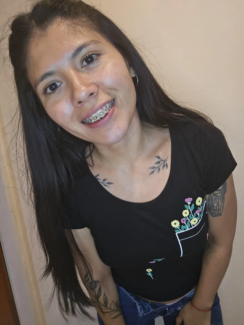 Do you like my braces? posted by Rufinitavip