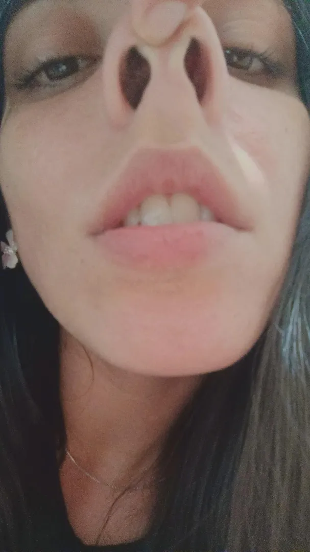 Do you like my nose? posted by Goddes_isa