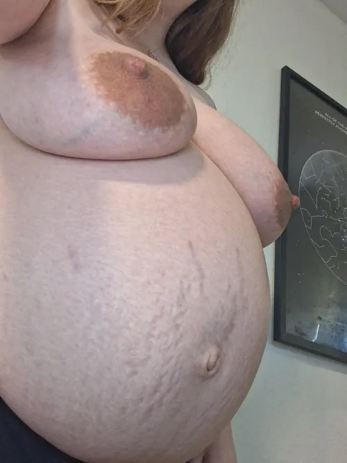 Do you like my stretch marks? by sammisquirtle