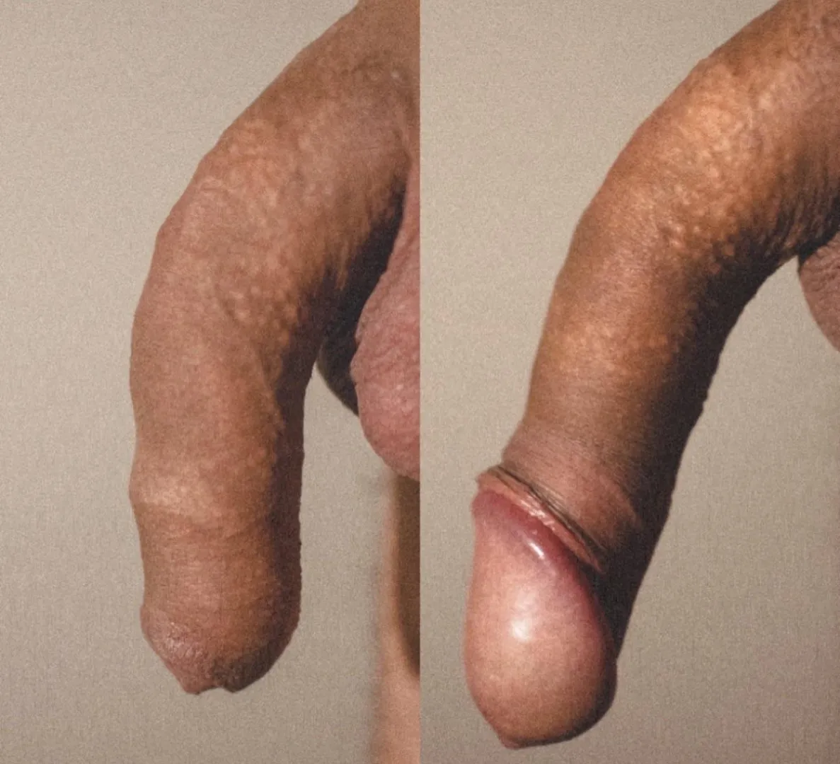 Do you prefer it covered or uncovered? posted by Silent-Fir