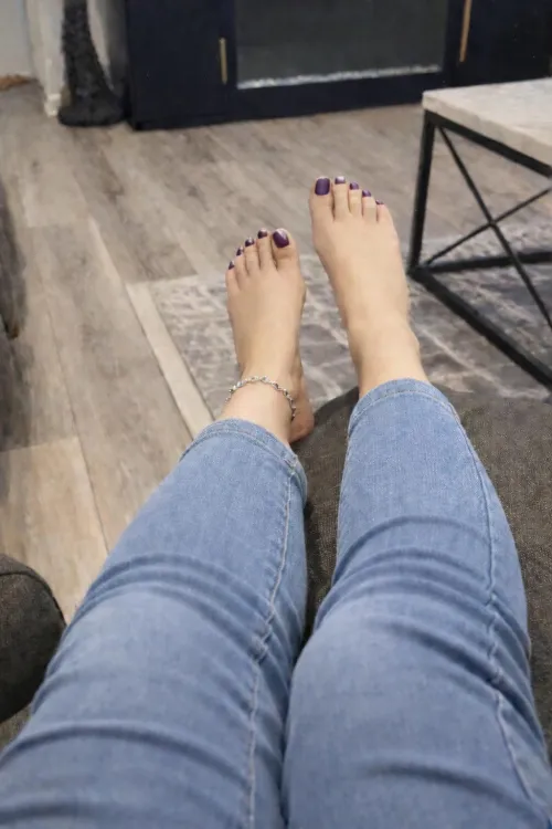 Do you think my toes need some more moisturizer?? by Dry-Tax5820