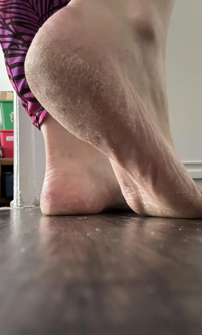 Dry, cracked, dirty….and you’re addicted. posted by empress_sophie3