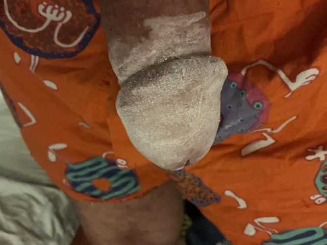 Drying my glans by tom1199