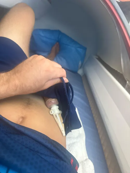 Dual Tension restorer + question by Accurate-Challenge-7