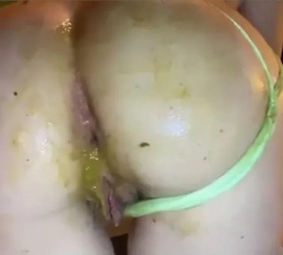 [F] scat playing content, ftm, Dropbox by Glad_Daikon_8465