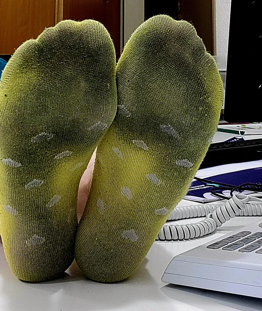 [F] Worn too long… and it shows  posted by MidnightSinn2025