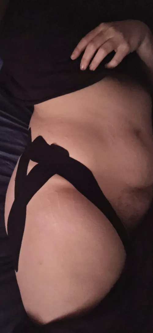 (F33 EDS) I'm still cute even though I'm taped up for yet another injury. by ThisIsAstrid