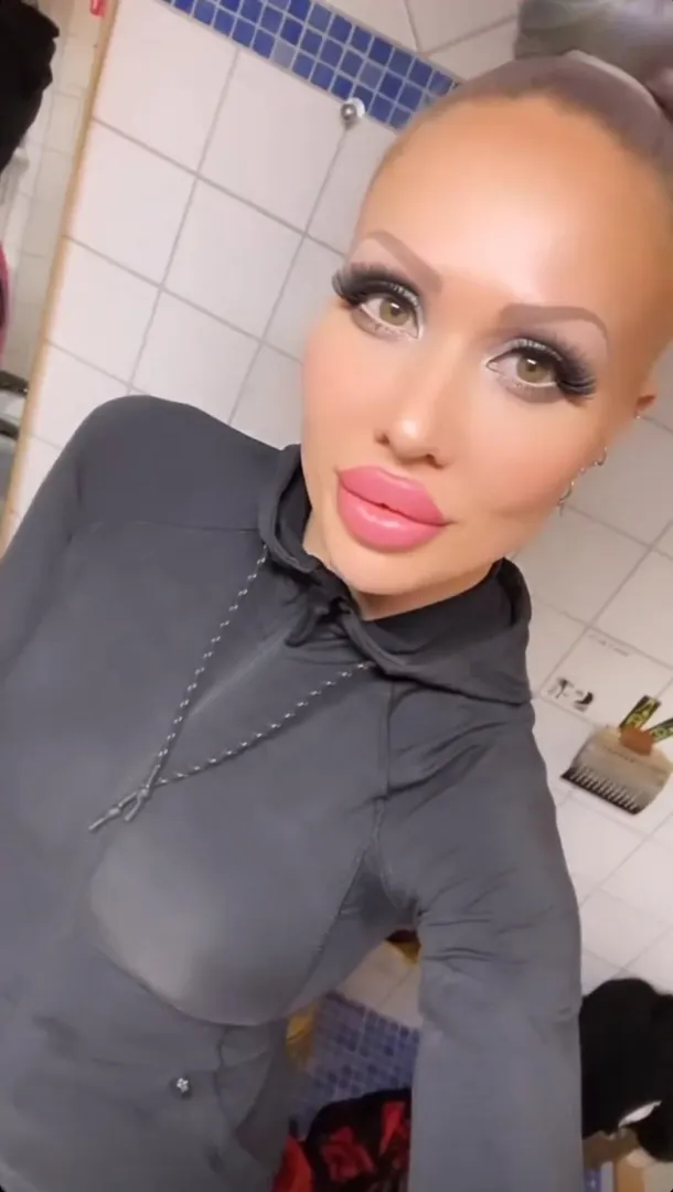 Filled and healed posted by tammygrl