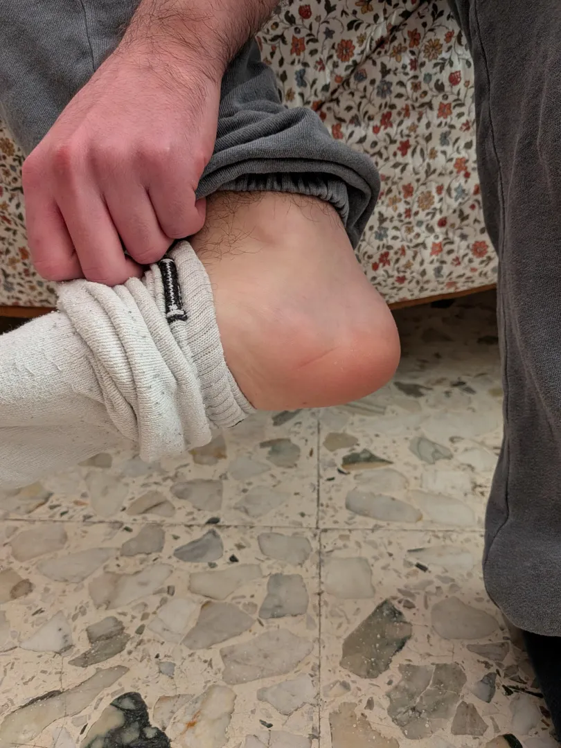 Finally i can shower.... posted by PepeFeet06