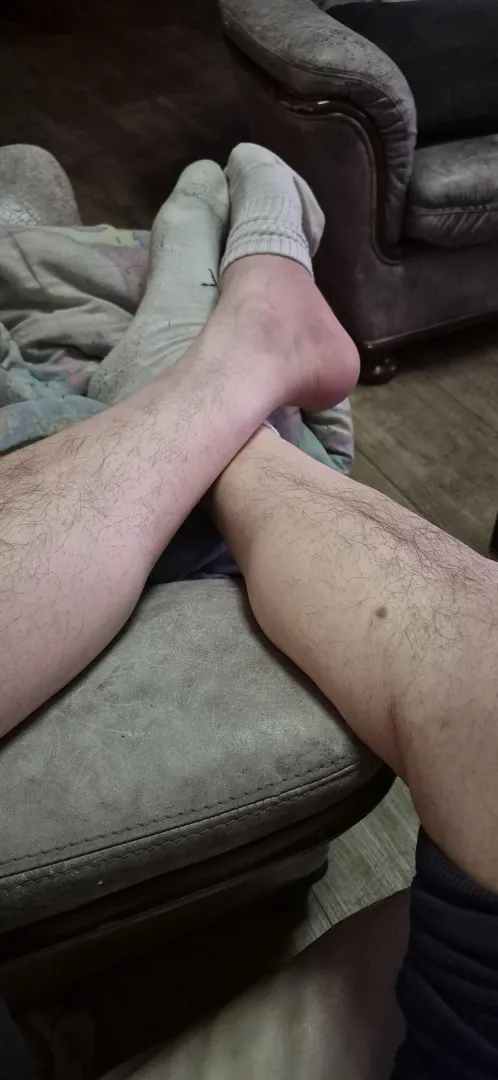 Finally off my feet… but the socks stayed on  posted by HairySockDad