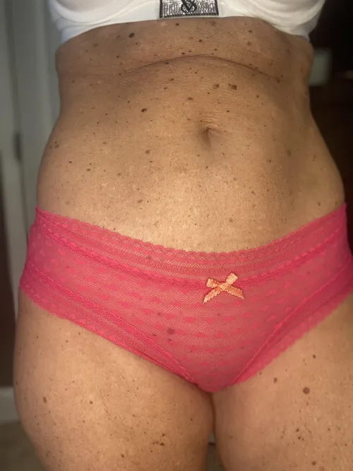 Find the freckle by Lotsoffun2024