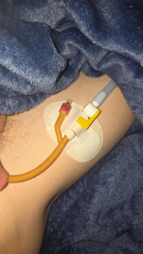 First cath in posted by Emergency_Driver1903