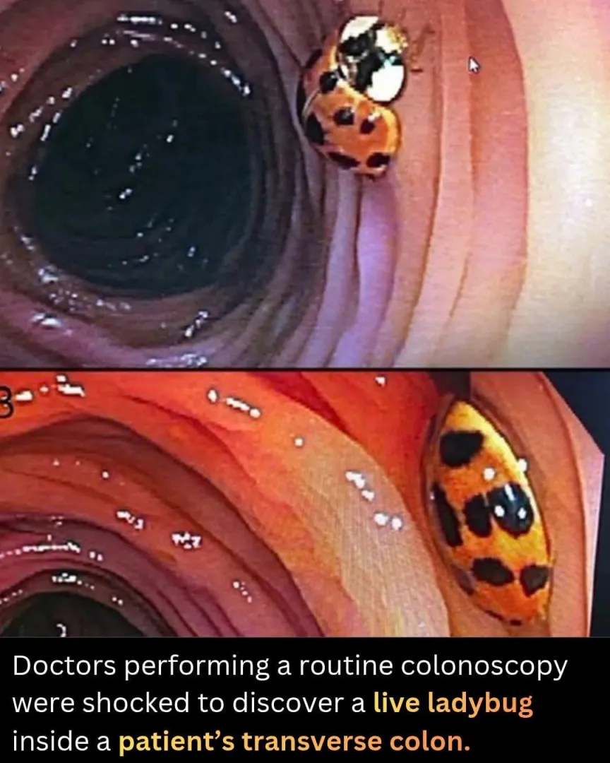 First Known Photograph of Adam posted by Based_Chink_69