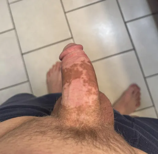 First post. So spotty by TumbleweedWeary6034