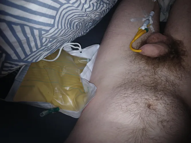 first time catheter with a night bag full of piss by baak20001
