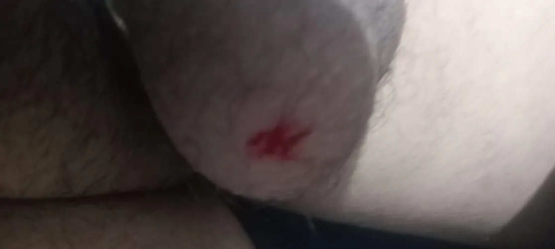 first time by TopkekesD6