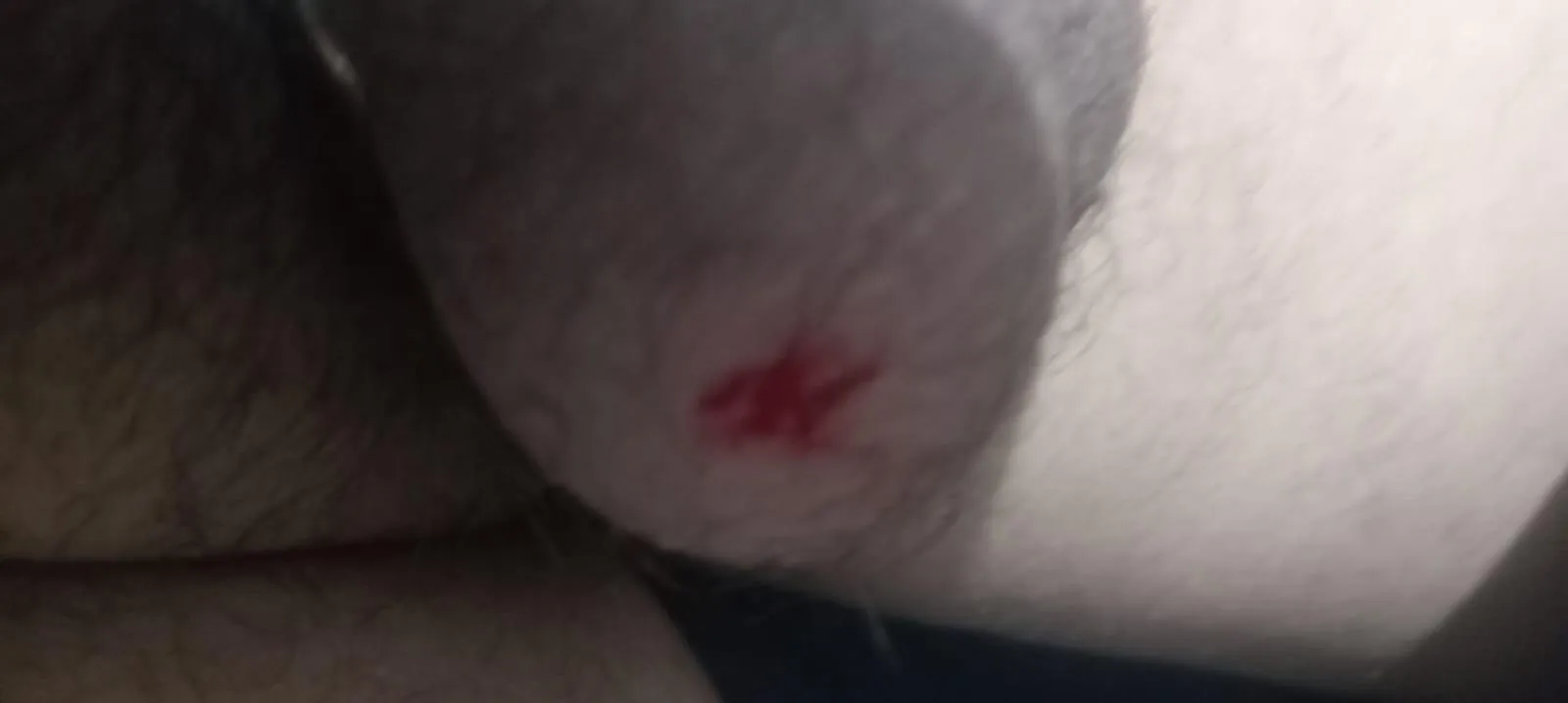 first time posted by TopkekesD6