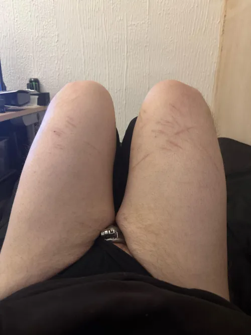 First time posting by Natural-Major1483