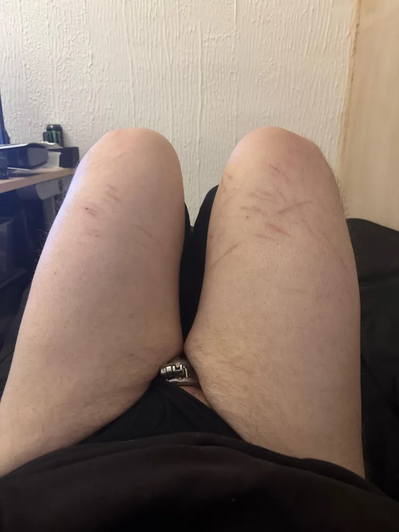 First time posting posted by Natural-Major1483