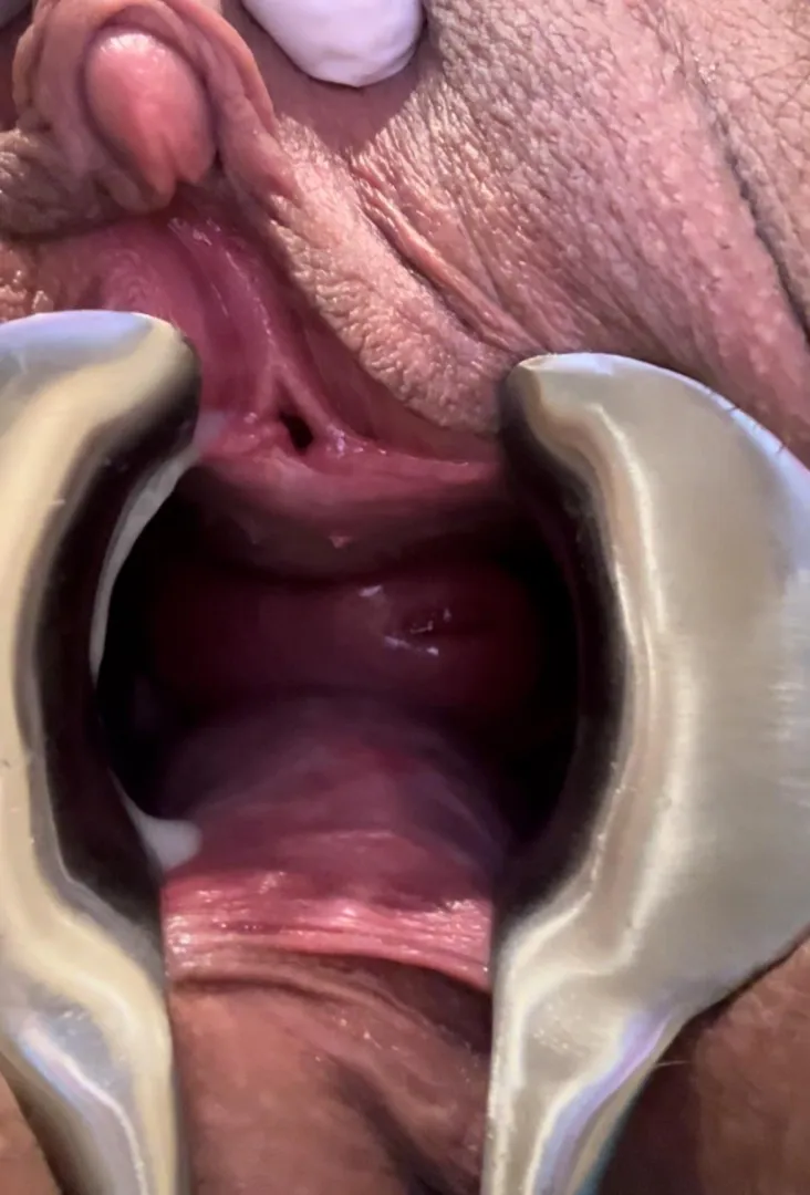 Follow up posted by FTM013