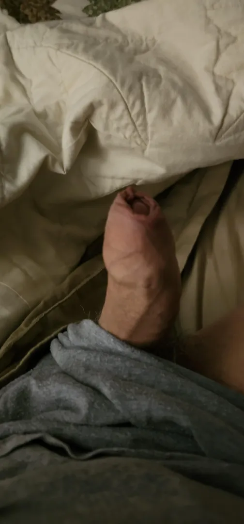 Foreskin posted by Doppler-10