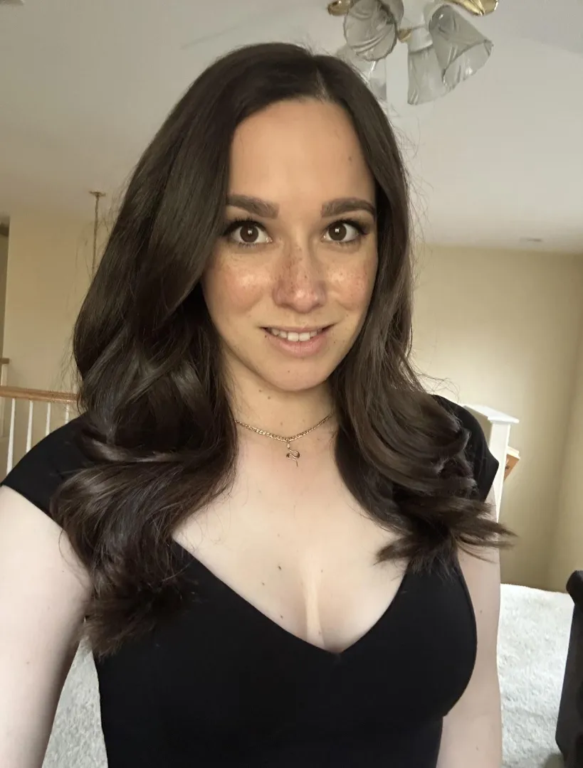 Freckles on freckles on freckles. posted by AlanaAraya