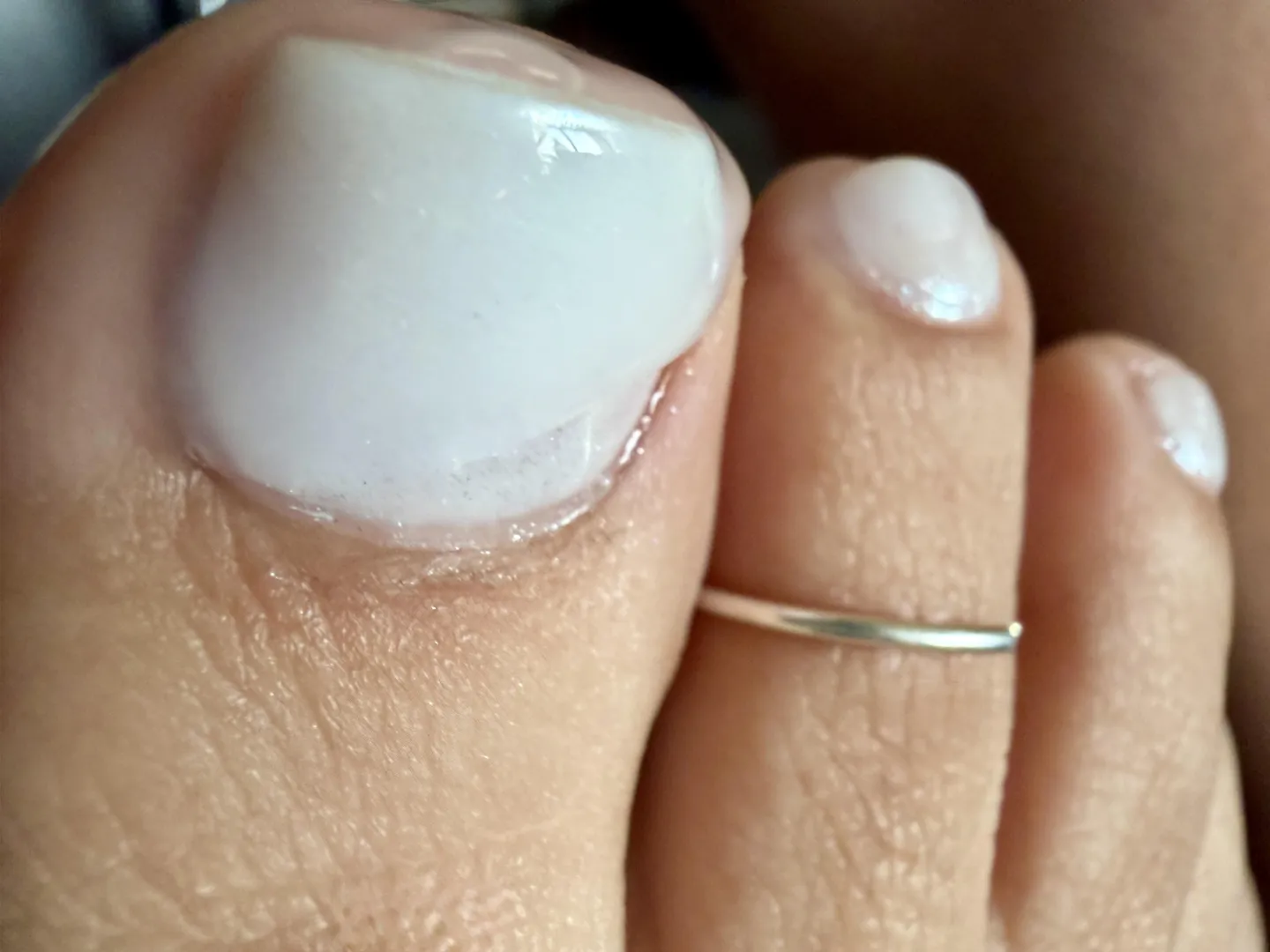 Fresh white toes… and a little extra shine posted by Interesting-Pen3846