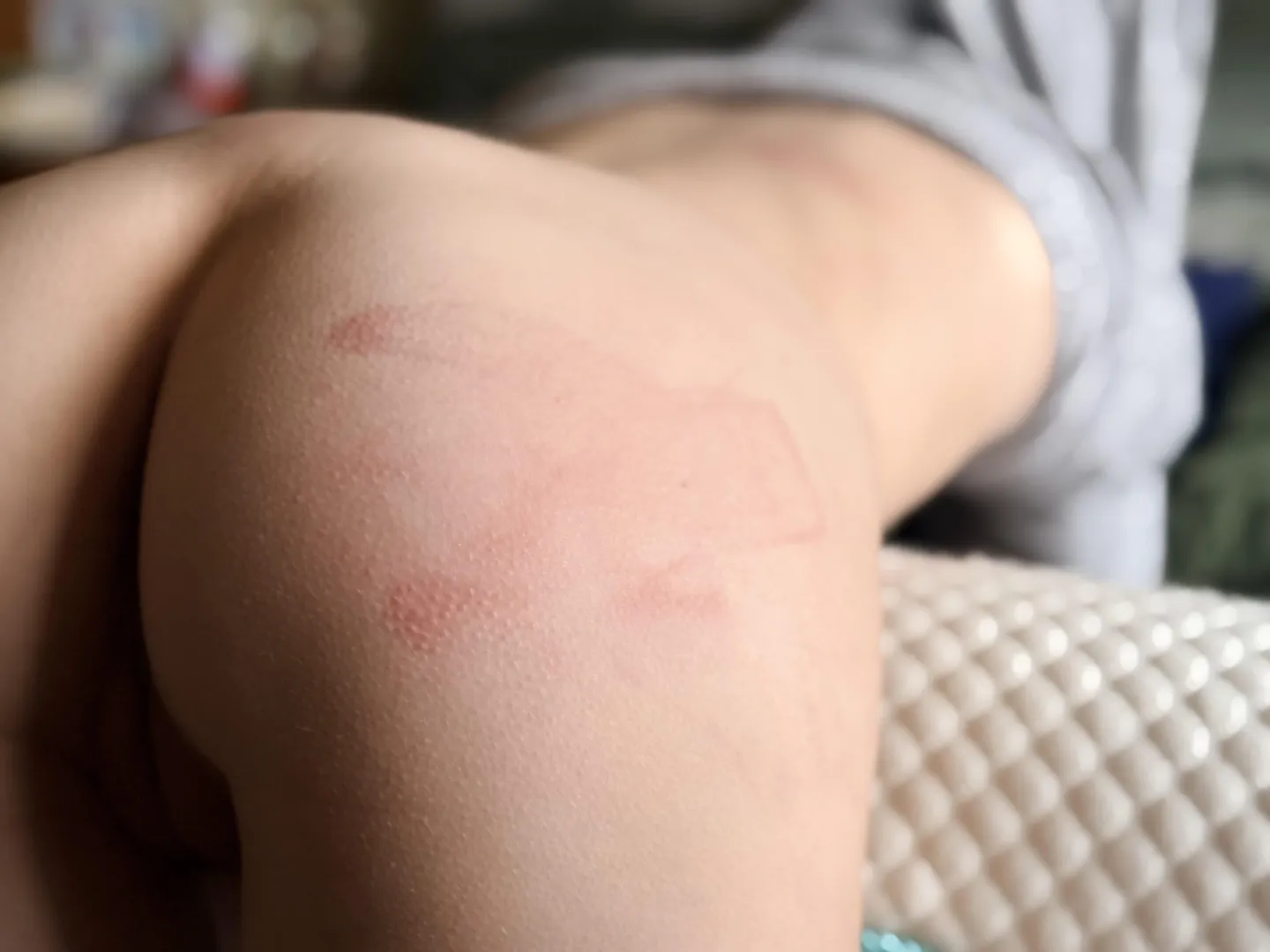 Gave me goosebumps posted by BruisedBallerina