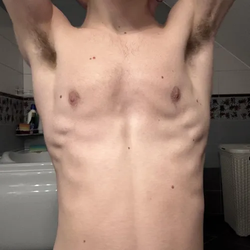 getting a lil hairy by fuzzytwinkk