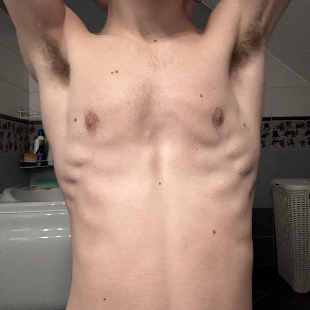 getting a lil hairy posted by fuzzytwinkk